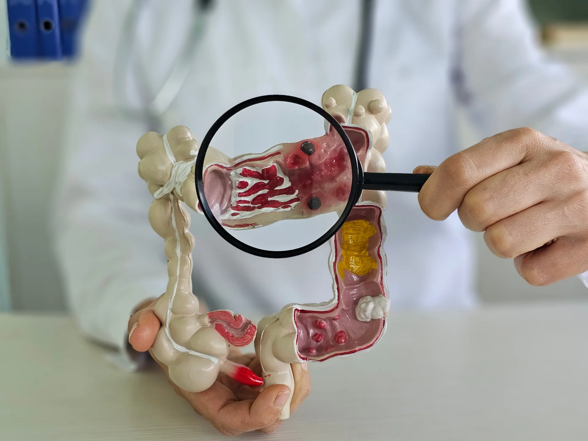 Резекция поперечно-ободочной кишки