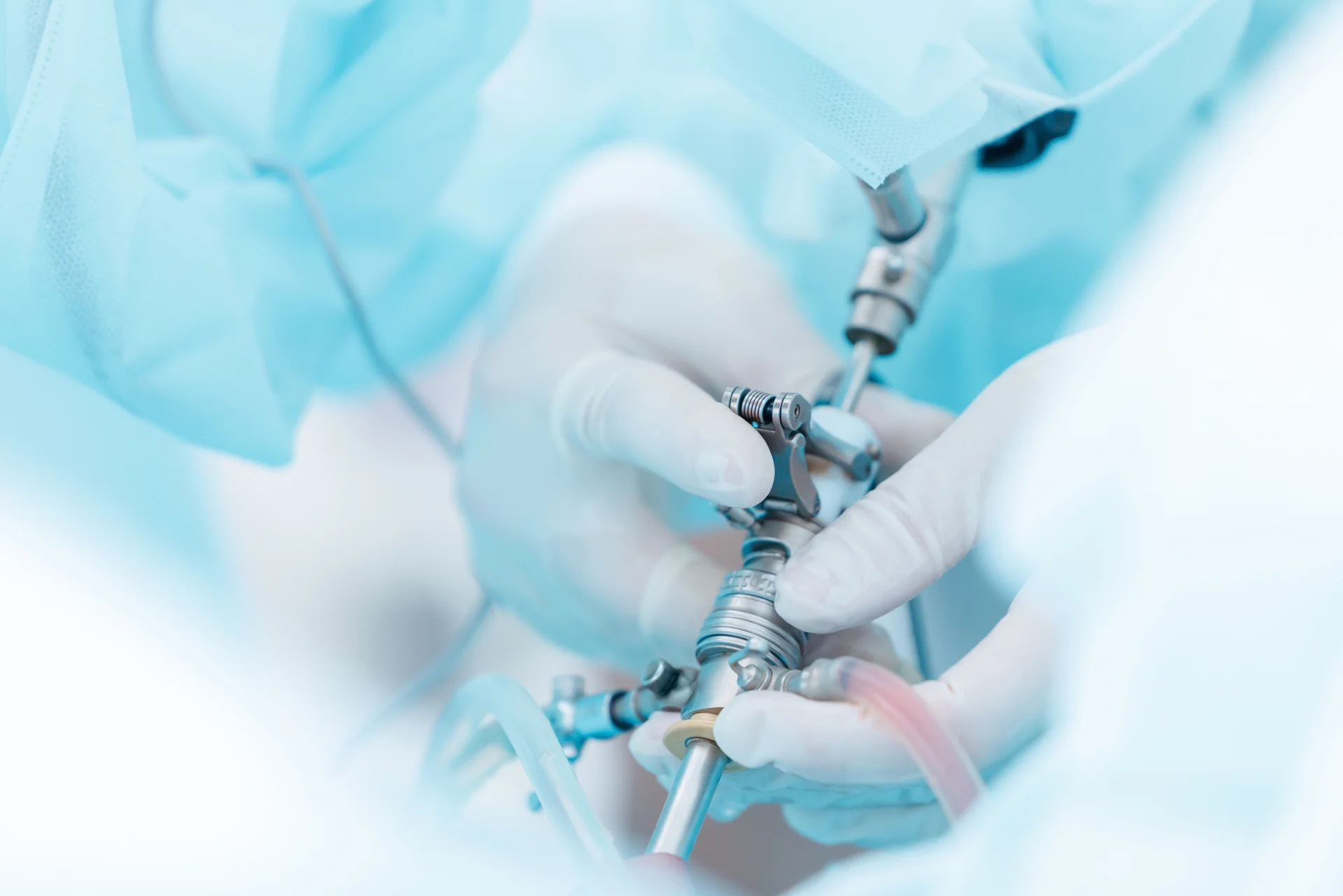 Лечение стриктуры мочеточника