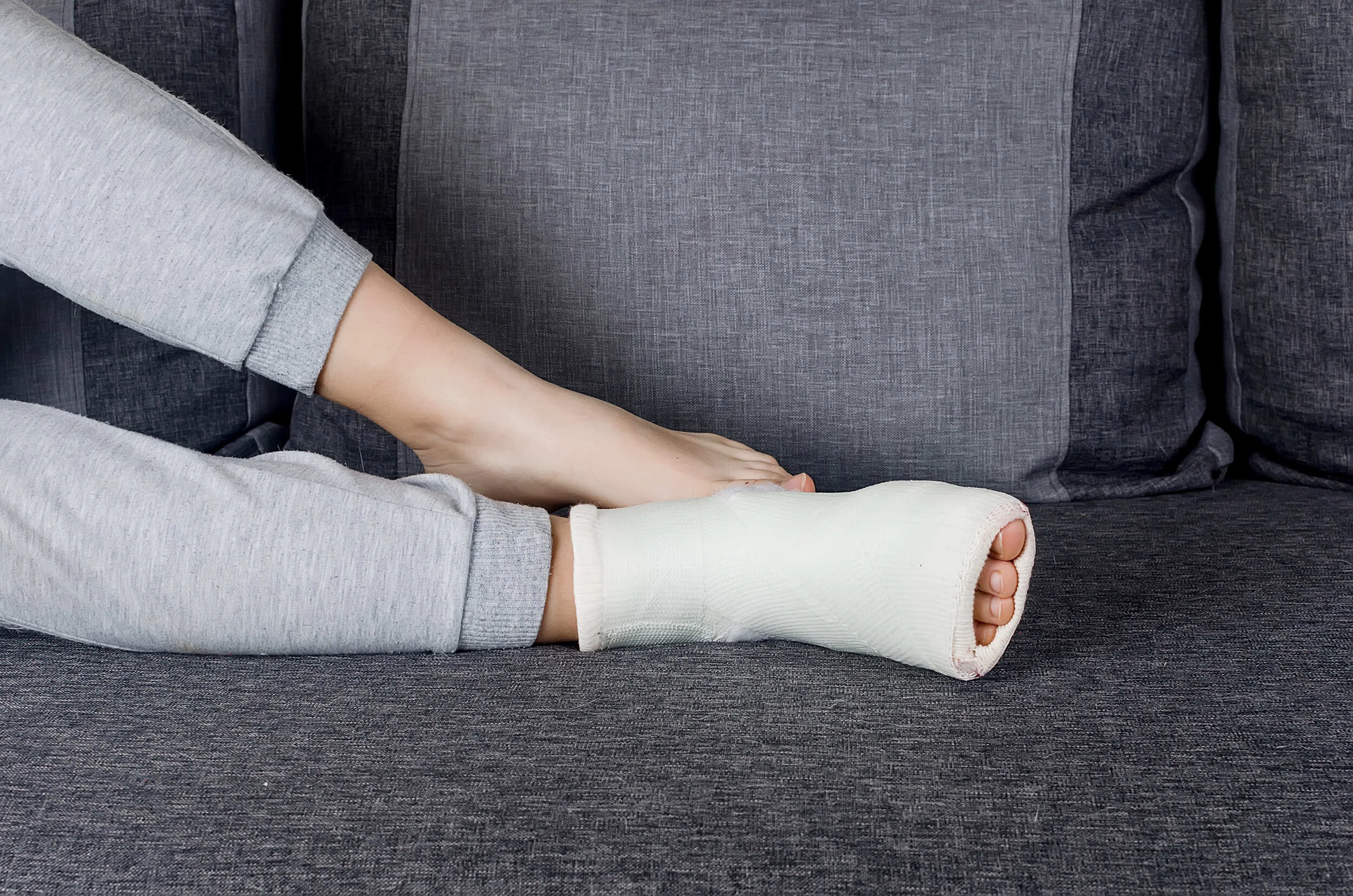 Переломы костей