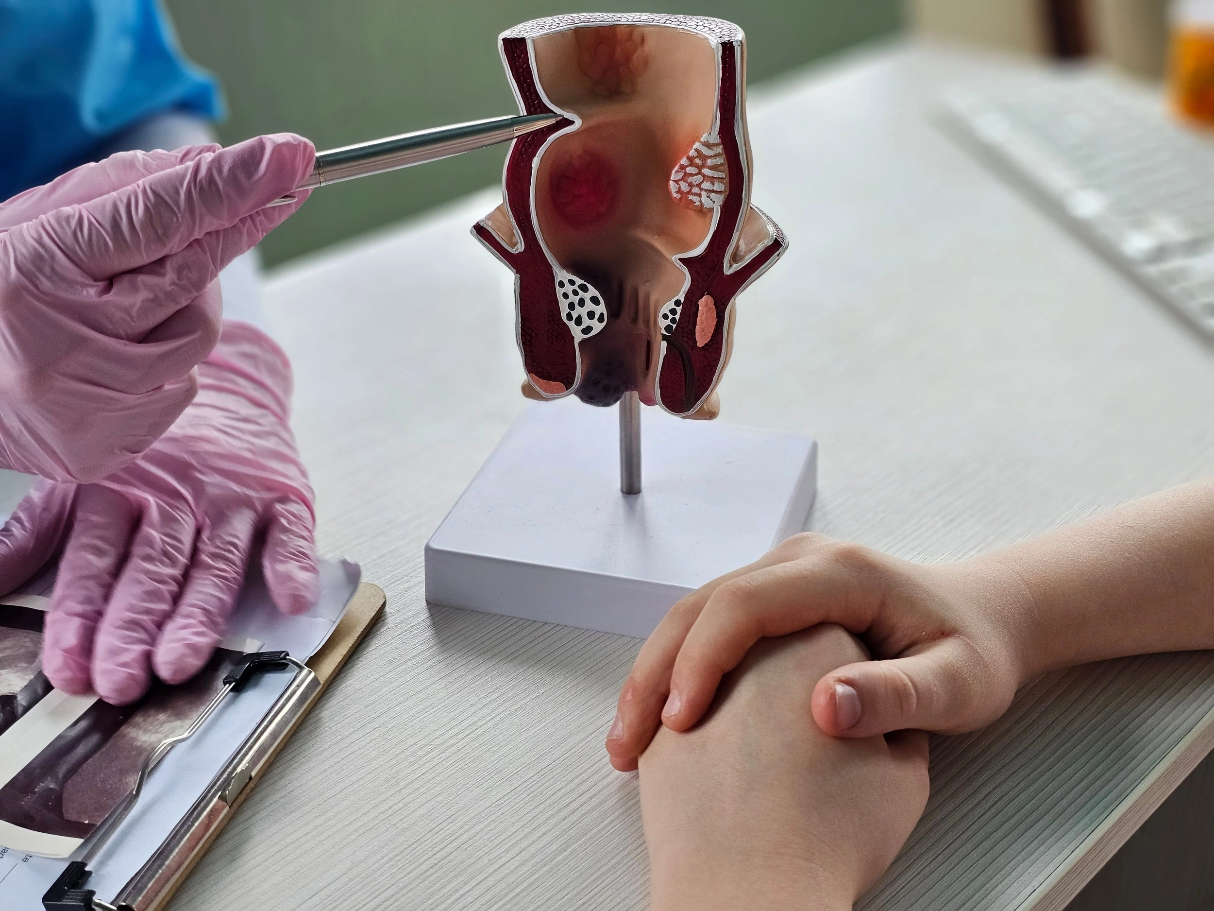 Анальная трещина