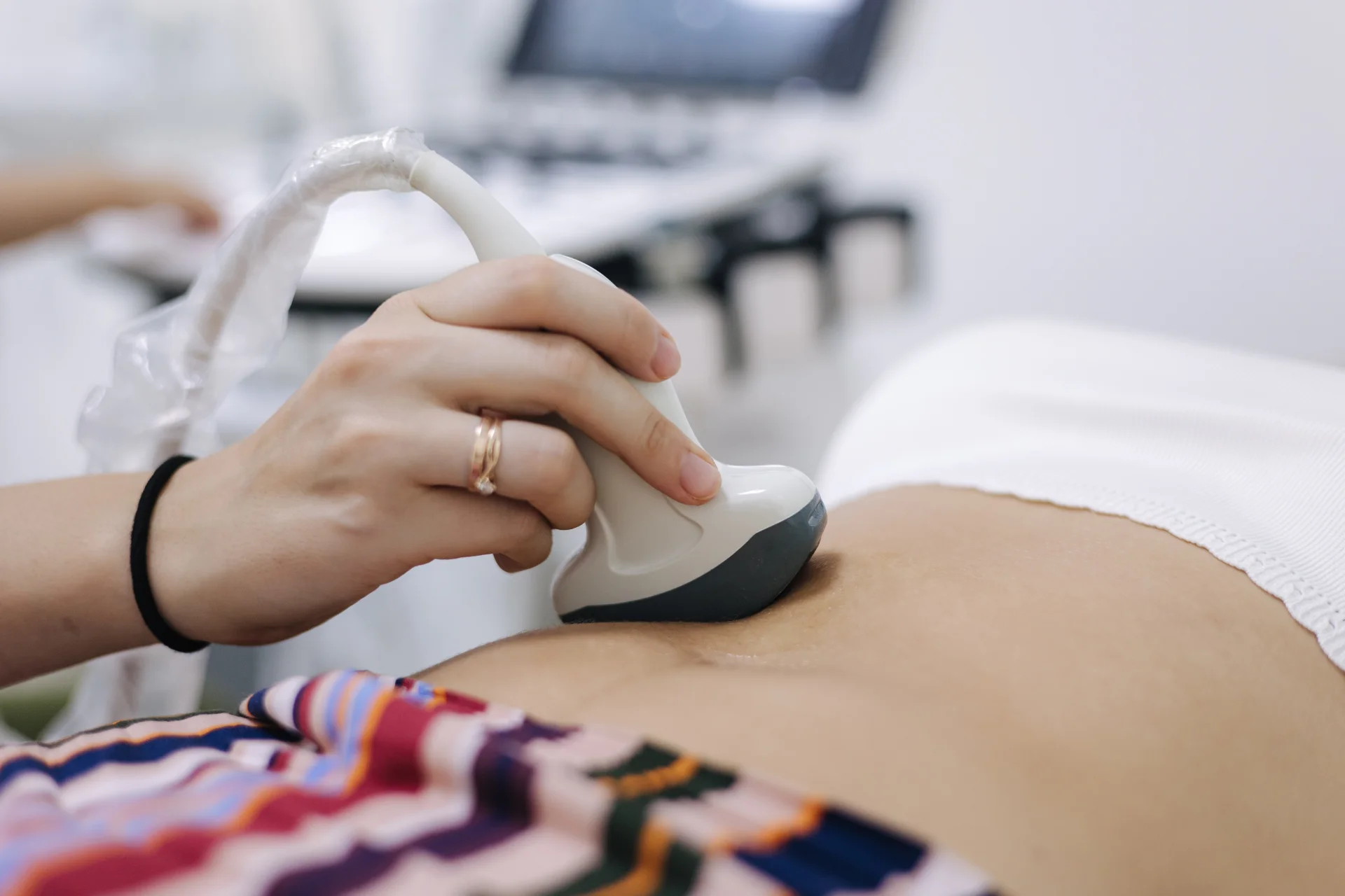 Колостомия