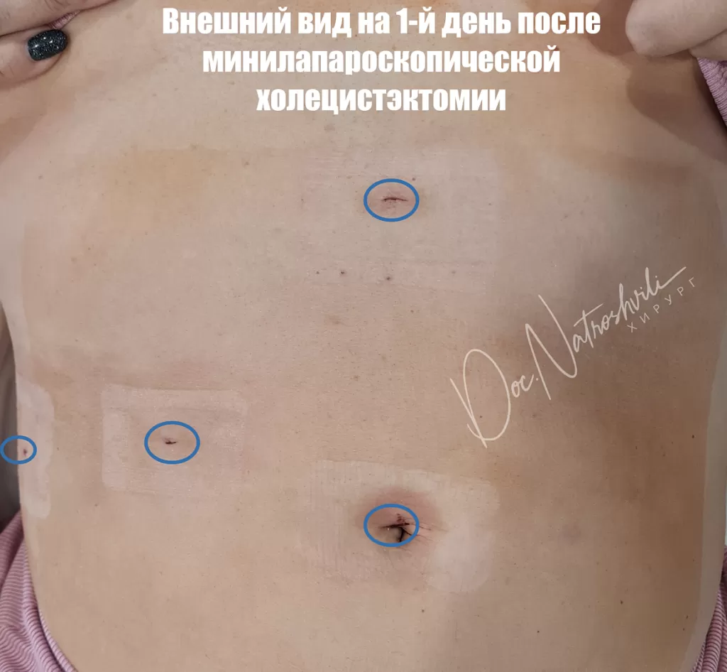 писсинг уретра Цистоскопия мочевого пузыря - Клиника Здоровье 365 г. Екатеринбург