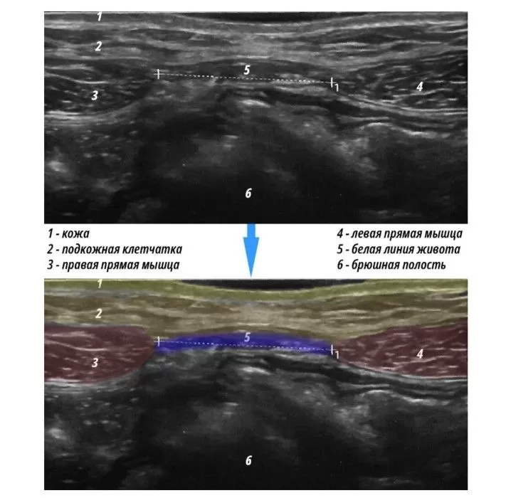 Сүйкімді эротикалық бейне